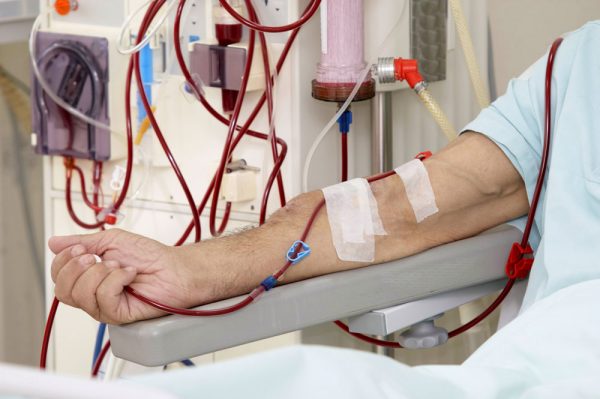 Dialysis Treatment: How It Can Improve Kidney Function